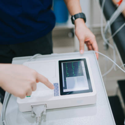 Szívritmuszavar - Kardio Központ